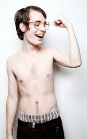 bentuk tubuh ectomorph