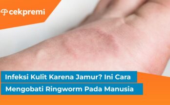 cara mengobati ringworm pada manusia
