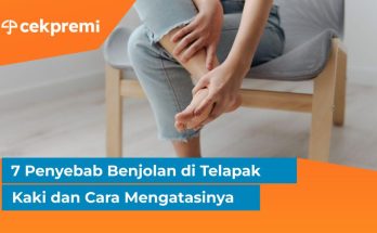 Benjolan di Telapak Kaki