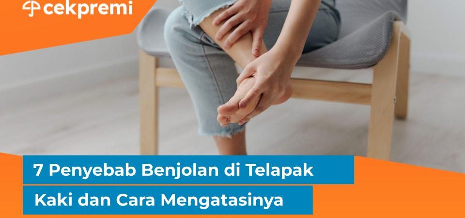Benjolan di Telapak Kaki