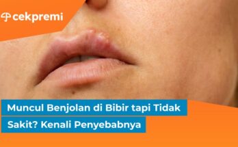 benjolan di bibir tapi tidak sakit