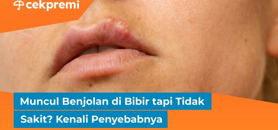 benjolan di bibir tapi tidak sakit