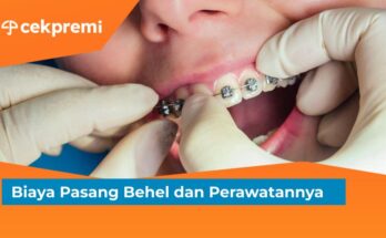 biaya pasang behel