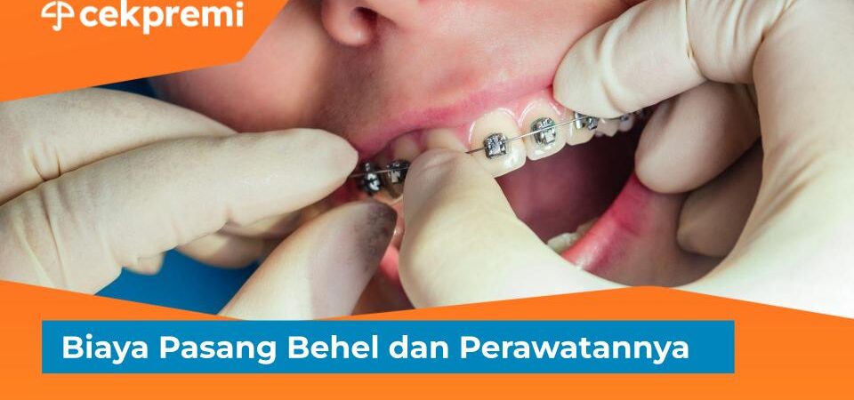biaya pasang behel