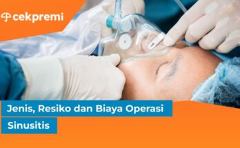 biaya operasi sinusitis