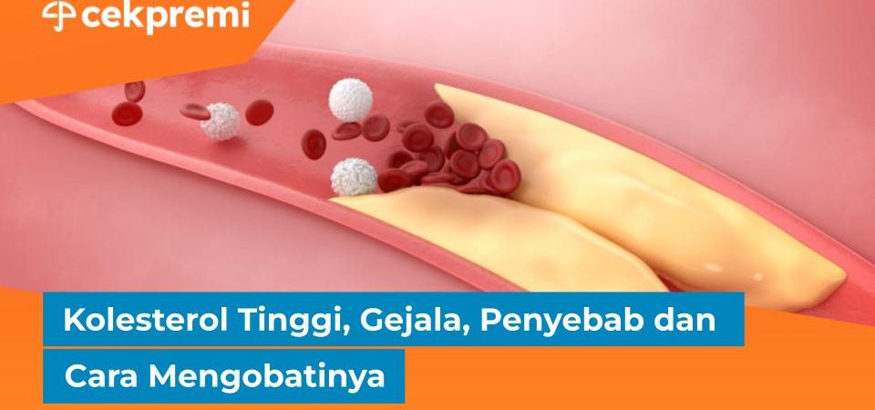 kolesterol tinggi