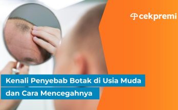 Botak di Usia Muda