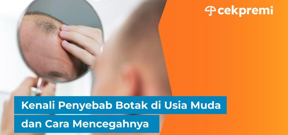 Botak di Usia Muda