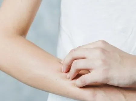 Kenali Tahapan Dan Penyebab Penyakit Herpes Sebelum Terlambat! 1 penyebab penyakit herpes